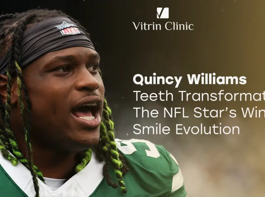 quincy williams teeth