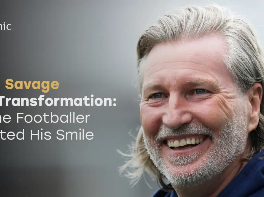 Robbie Savage Teeth Transformation: