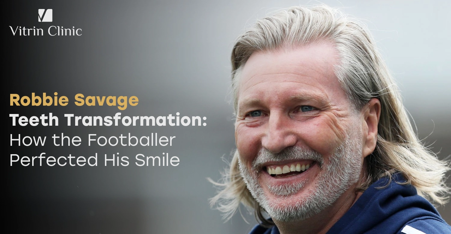 Robbie Savage Teeth Transformation: