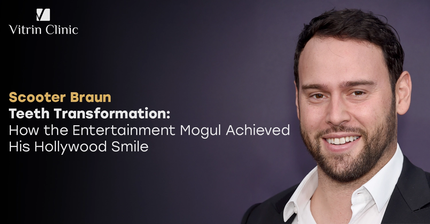Scooter Braun Teeth Transformation