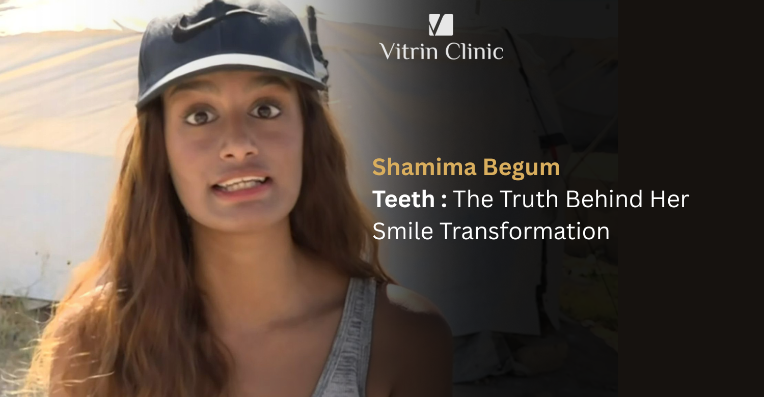 Shamima Begum Teeth