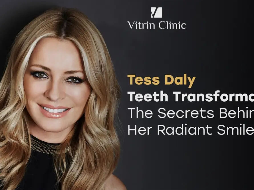 Tess Daly Teeth Transformation
