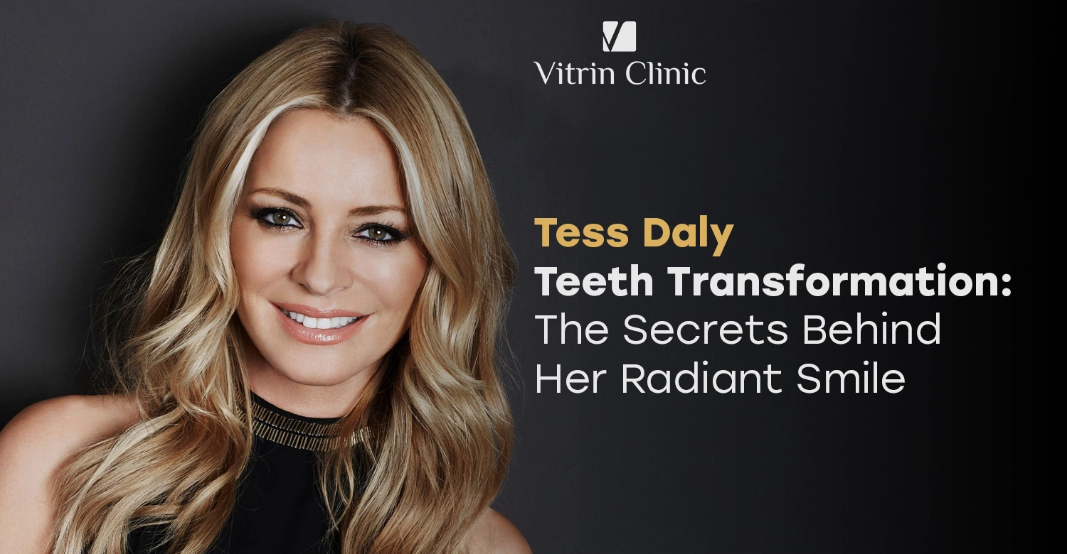 Tess Daly Teeth Transformation