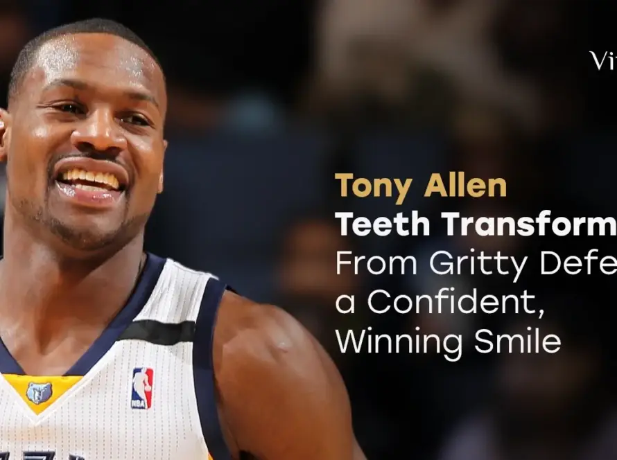 Tony Allen teeth