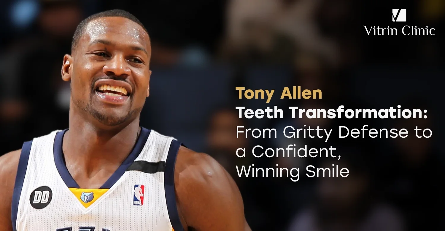 Tony Allen teeth