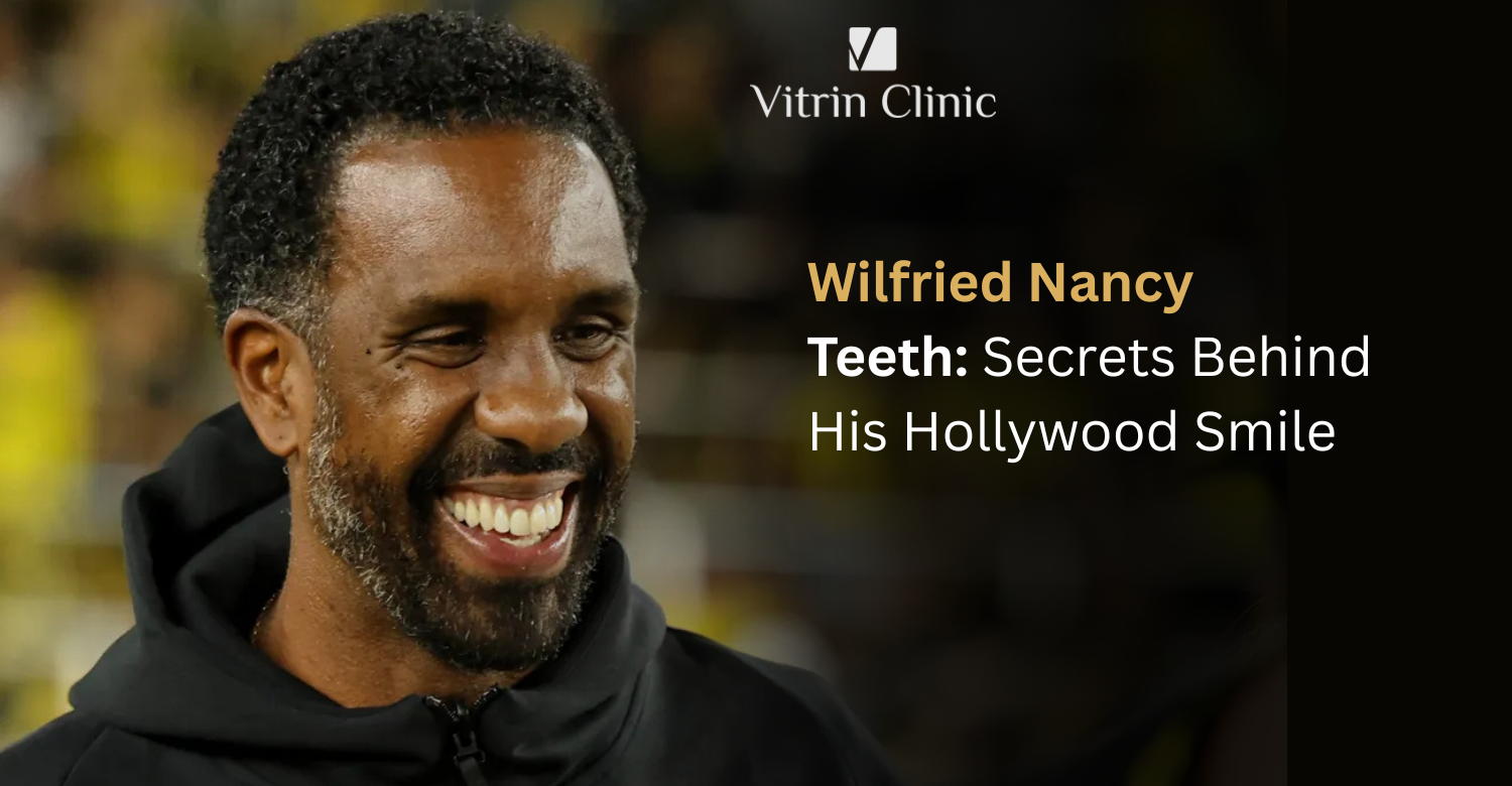 Wilfried Nancy Teeth