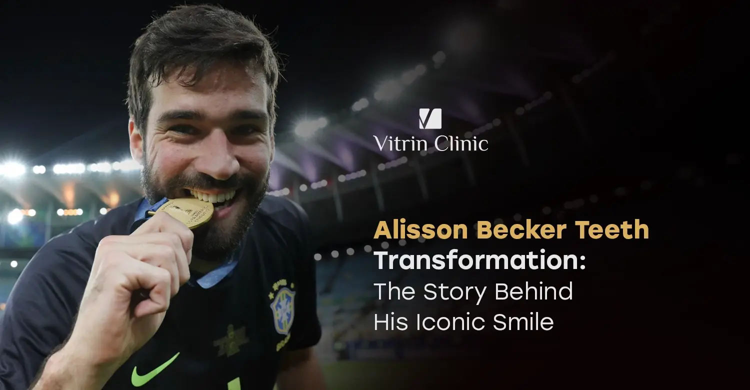 Alisson Becker Teeth Transformation