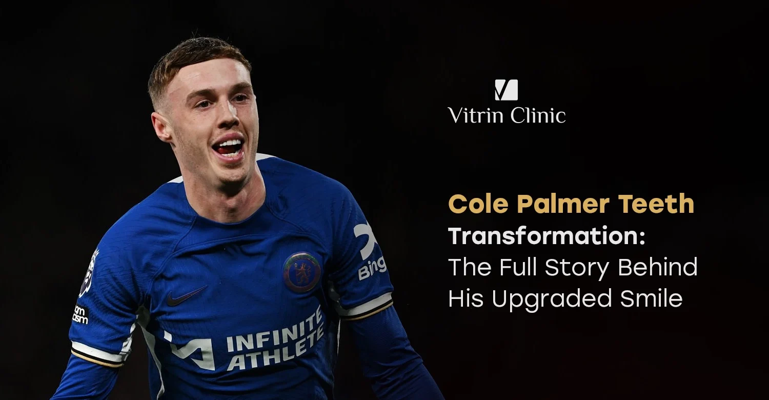 Cole Palmer Teeth