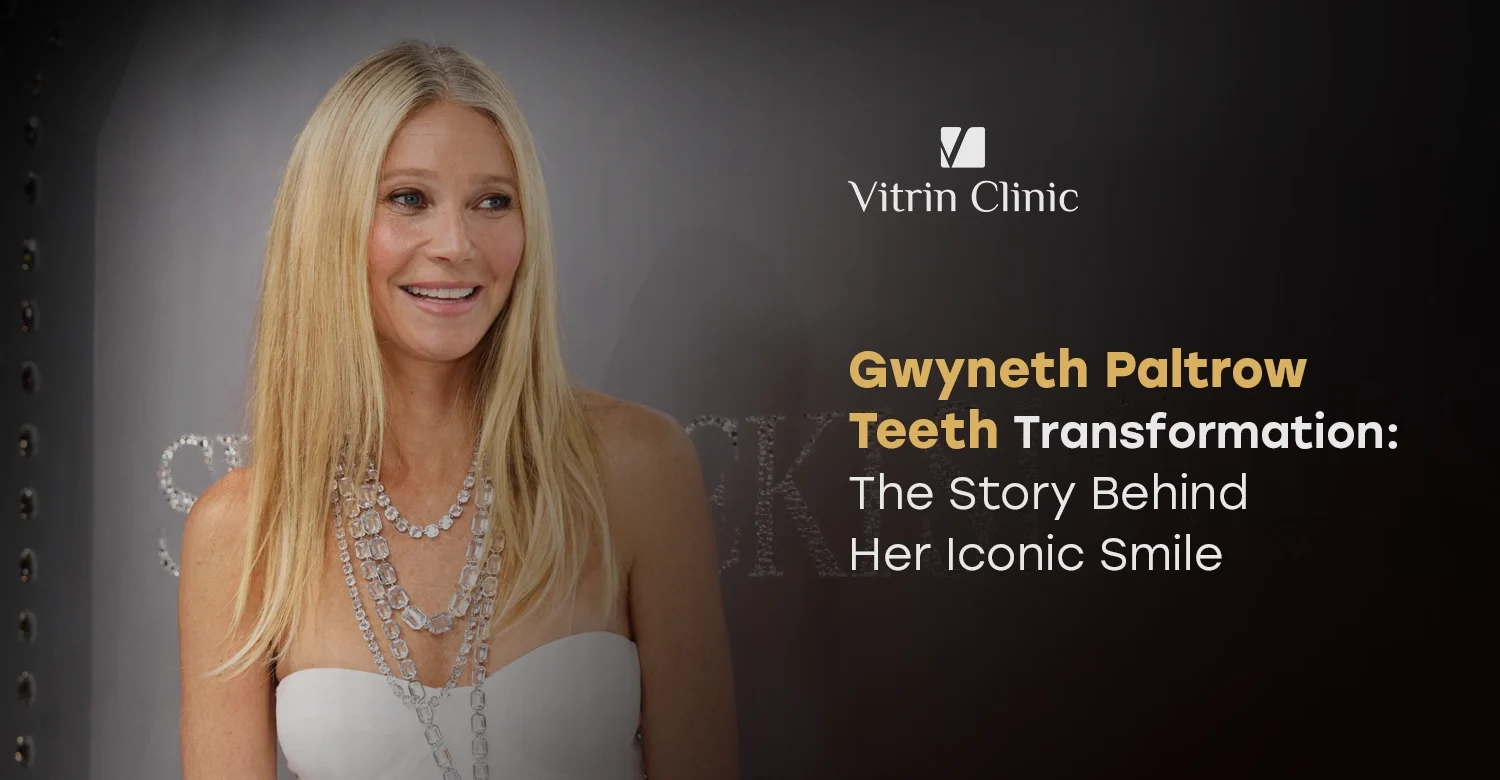 Gwyneth Paltrow Teeth Transformation: The Story Behind Her Iconic Smile