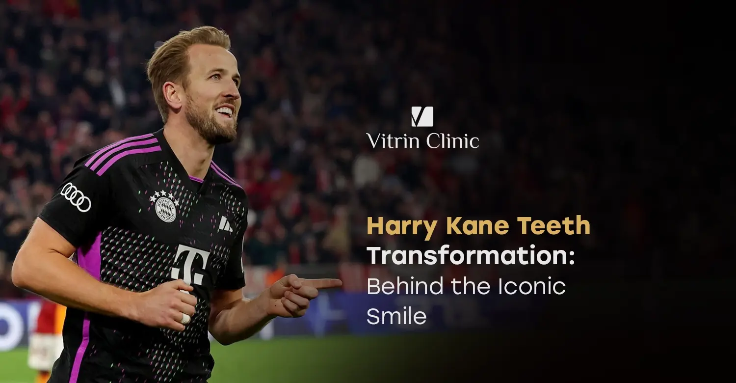 Harry Kane Teeth Transformation