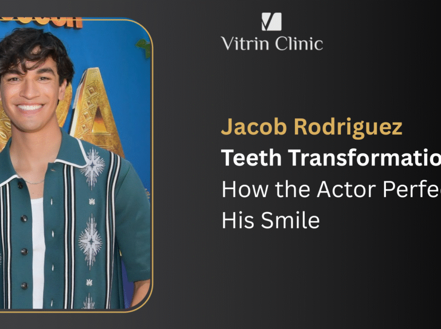 Jacob Rodriguez Teeth Transformation