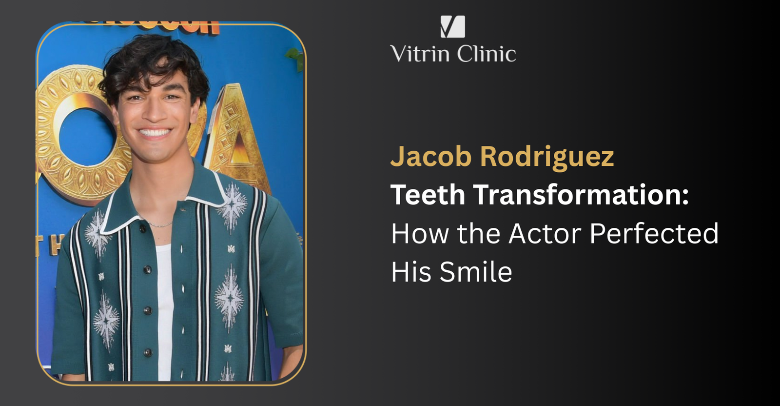 Jacob Rodriguez Teeth Transformation