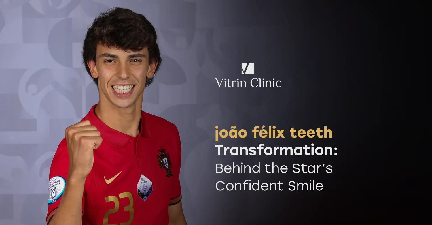 João Félix Teeth Transformation