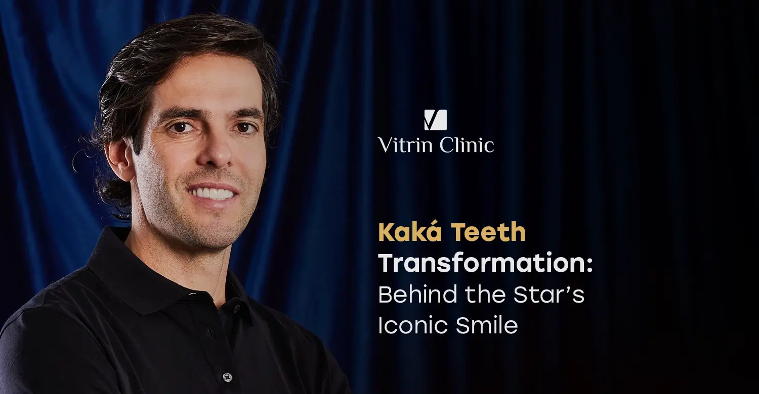 Kaká Teeth Transformation: Before & After Smile