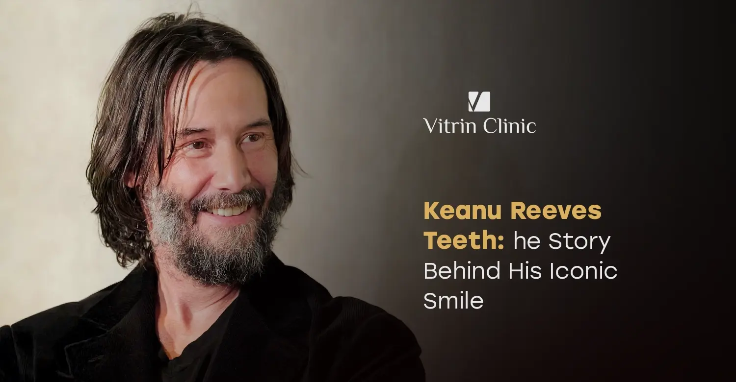 Keanu Reeves Teeth