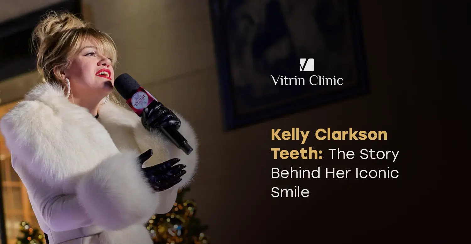 Kelly Clarkson Teeth