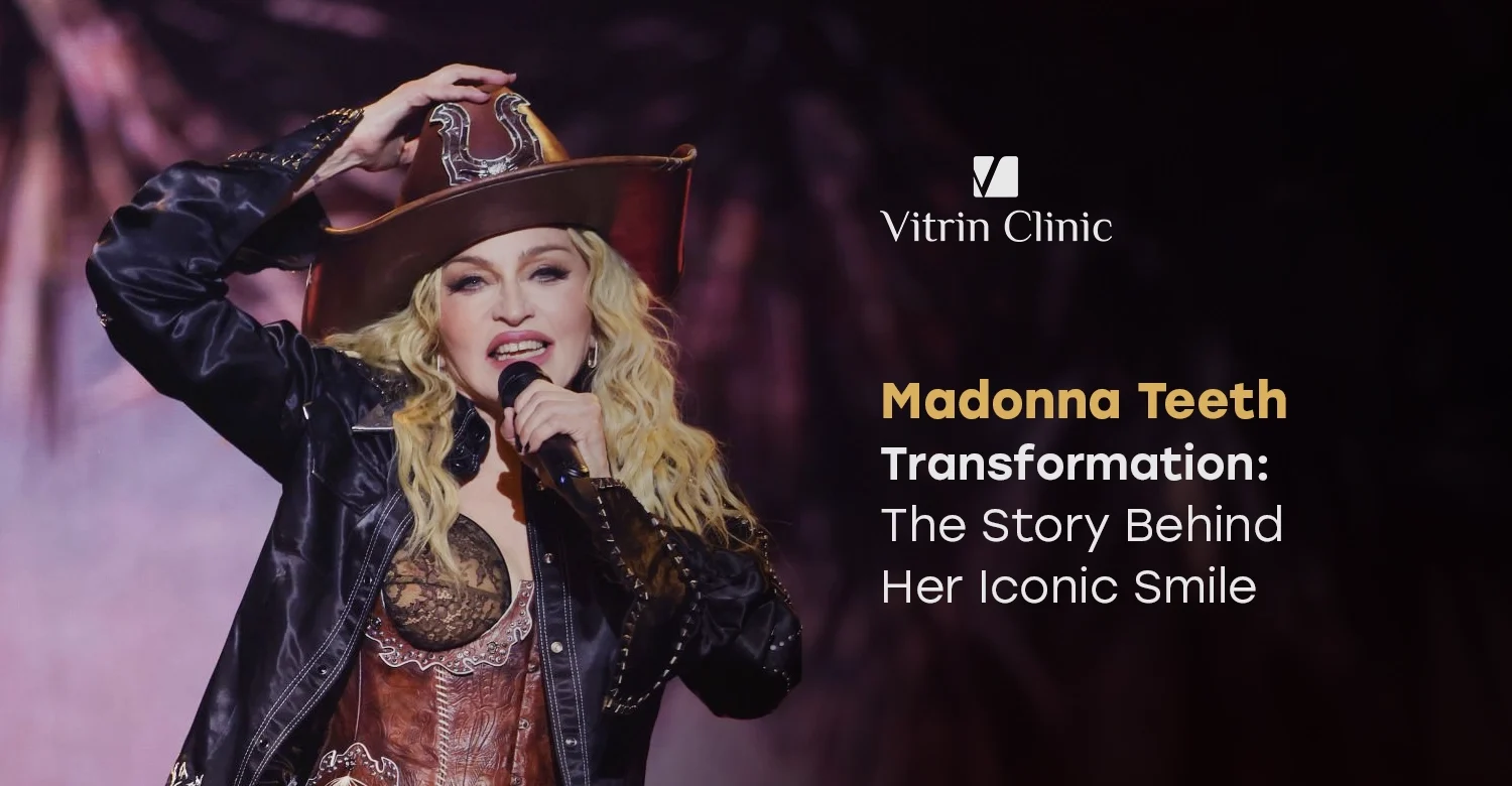 Madonna Teeth Transformation