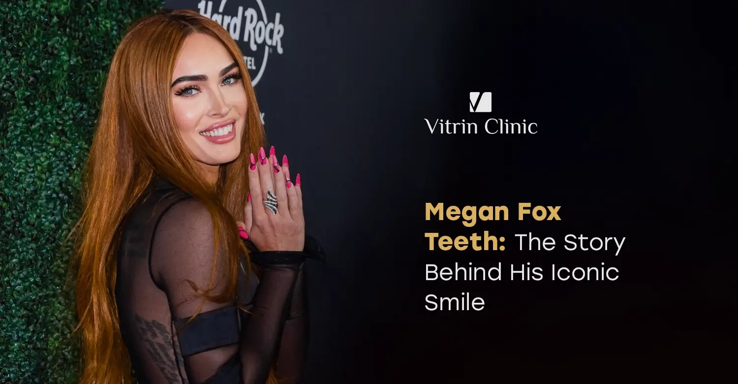 Megan Fox Teeth