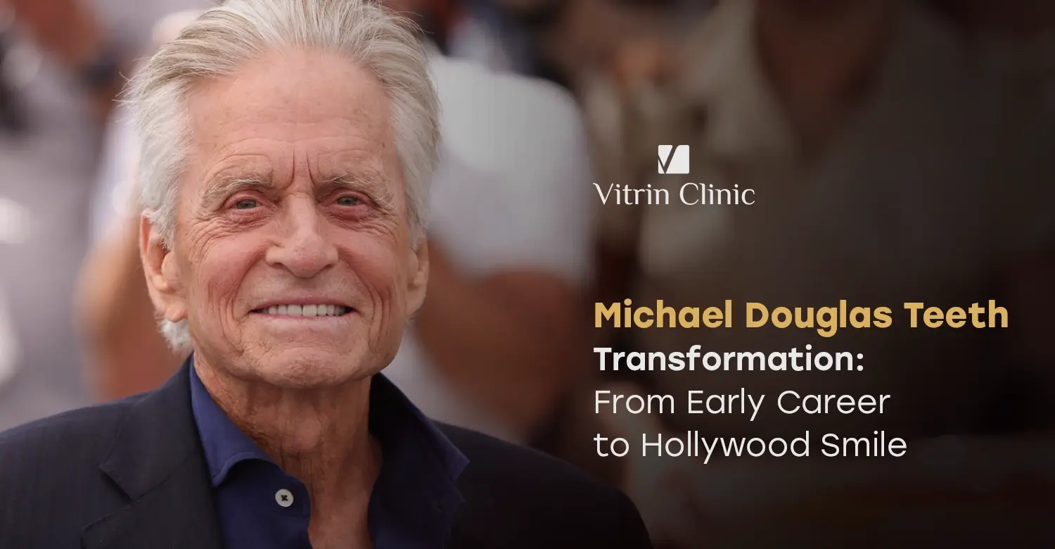 Michael Douglas Teeth