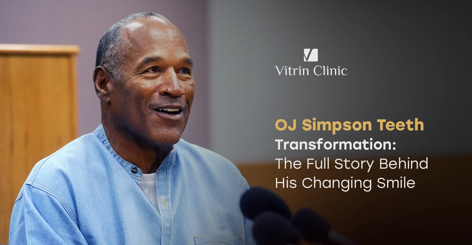 OJ Simpson Teeth Transformation