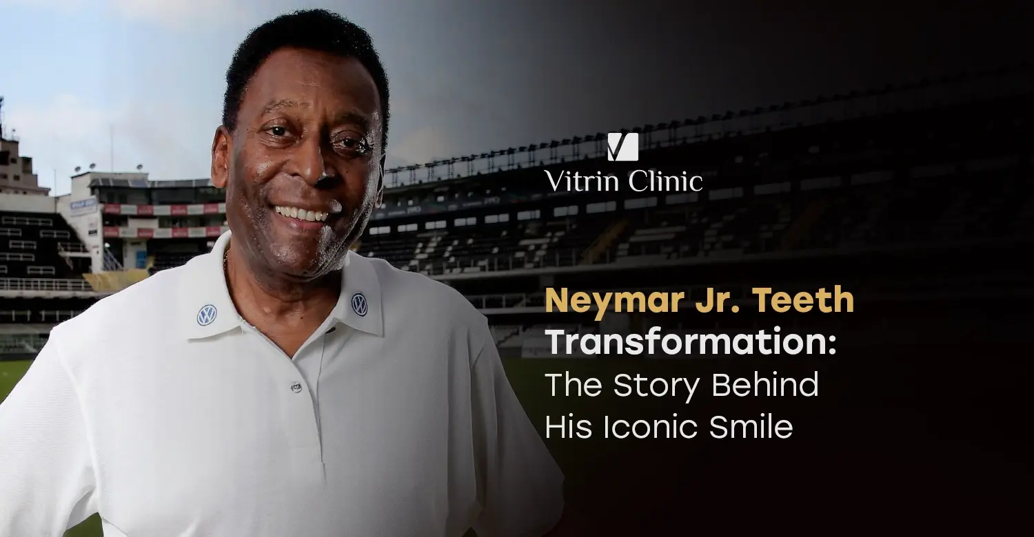 Pelé Teeth Transformation