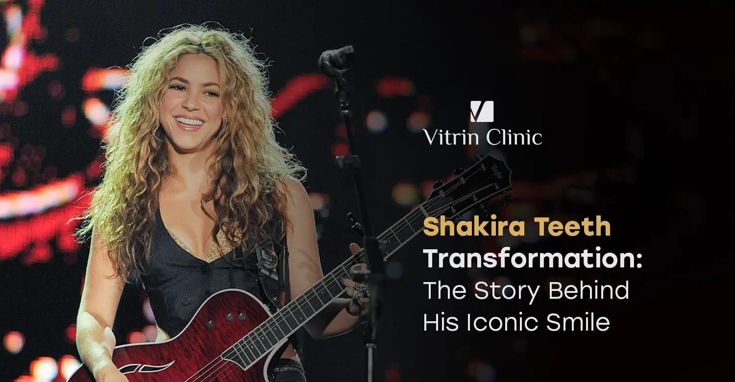 Shakira Teeth Transformation