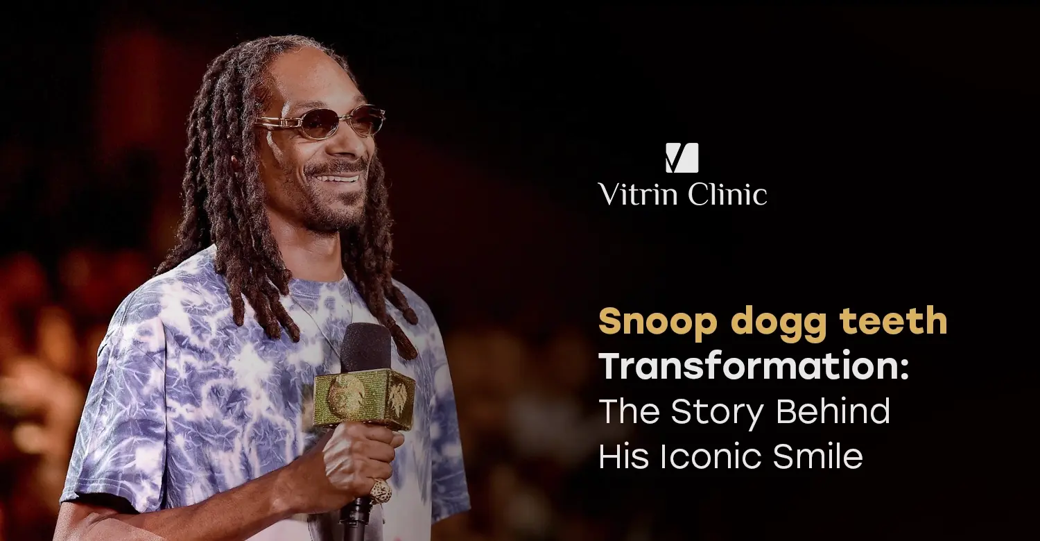 Snoop Dogg Teeth