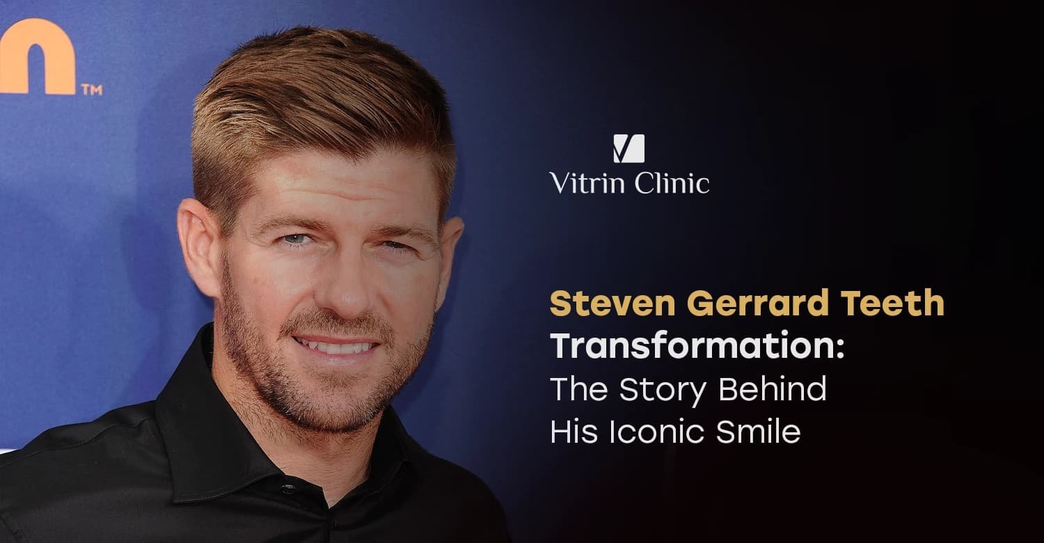 Steven Gerrard Teeth