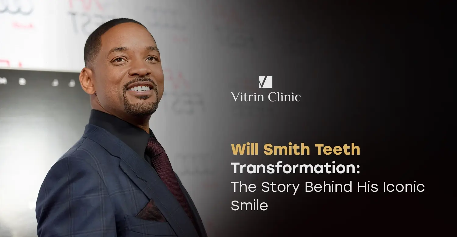 Will Smith Teeth Transformation