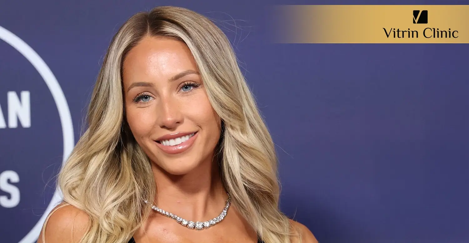 Alix Earle Teeth Transformation