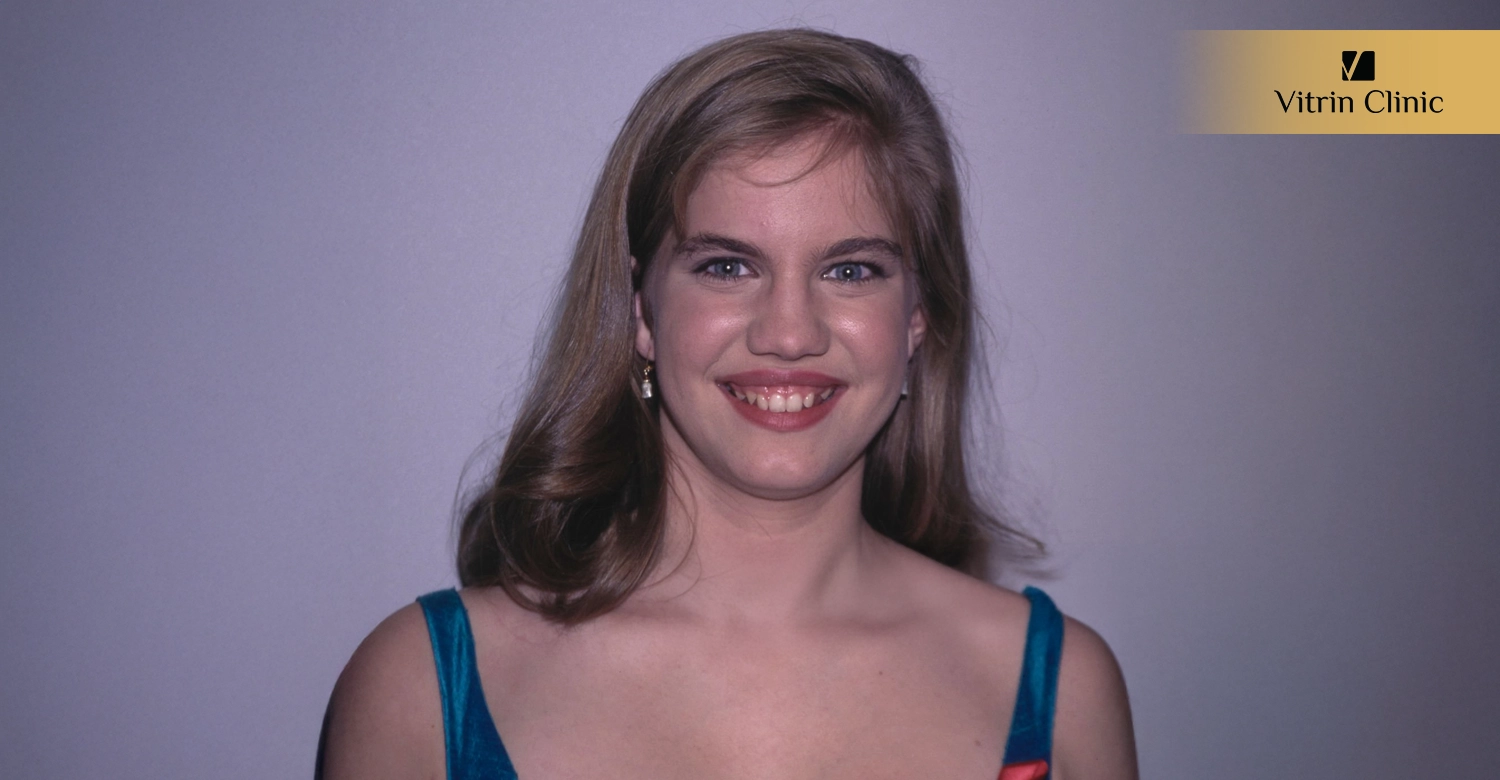 Why Does Anna Chlumsky's Smile Stand Out So Much?