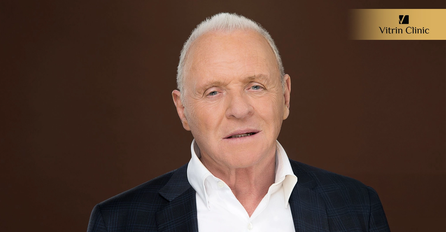 Did Anthony Hopkins Get Veneers or Cosmetic Dental Work?