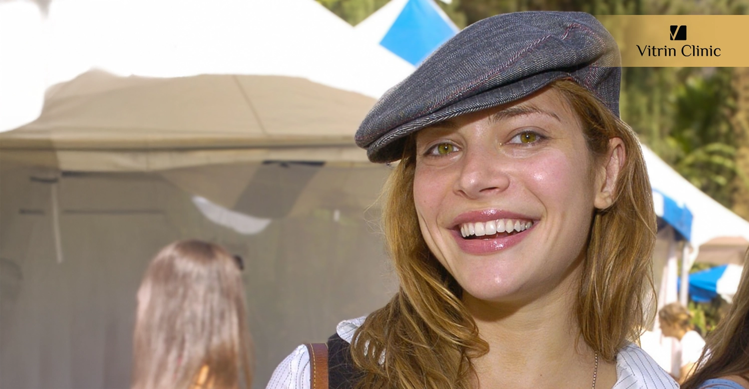 What Is the Public Reaction to Ayda Field's Smile Transformation?