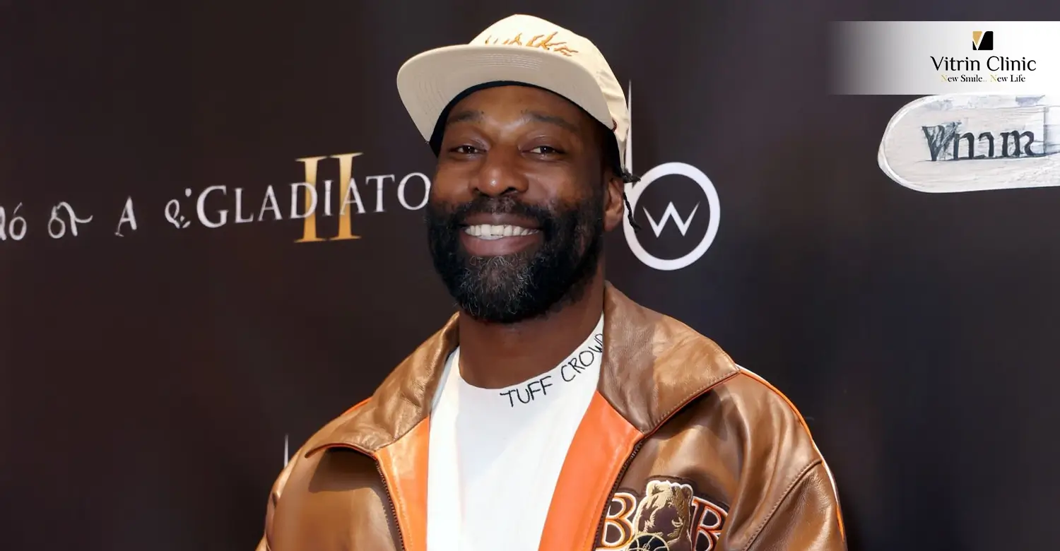 Baron Davis Teeth