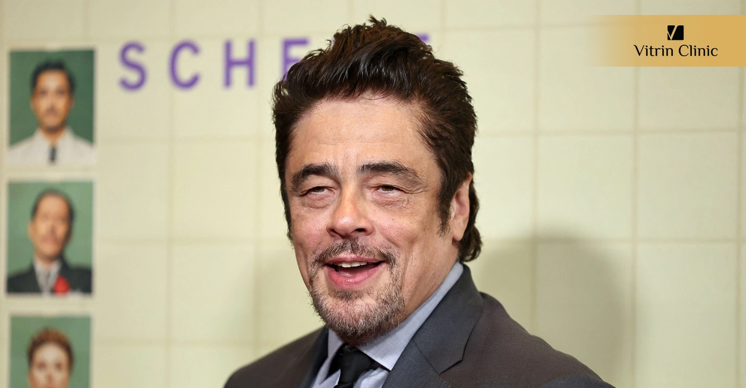Procédures Dentaires pour Recréer un Sourire Inspiré par Benicio del Toro