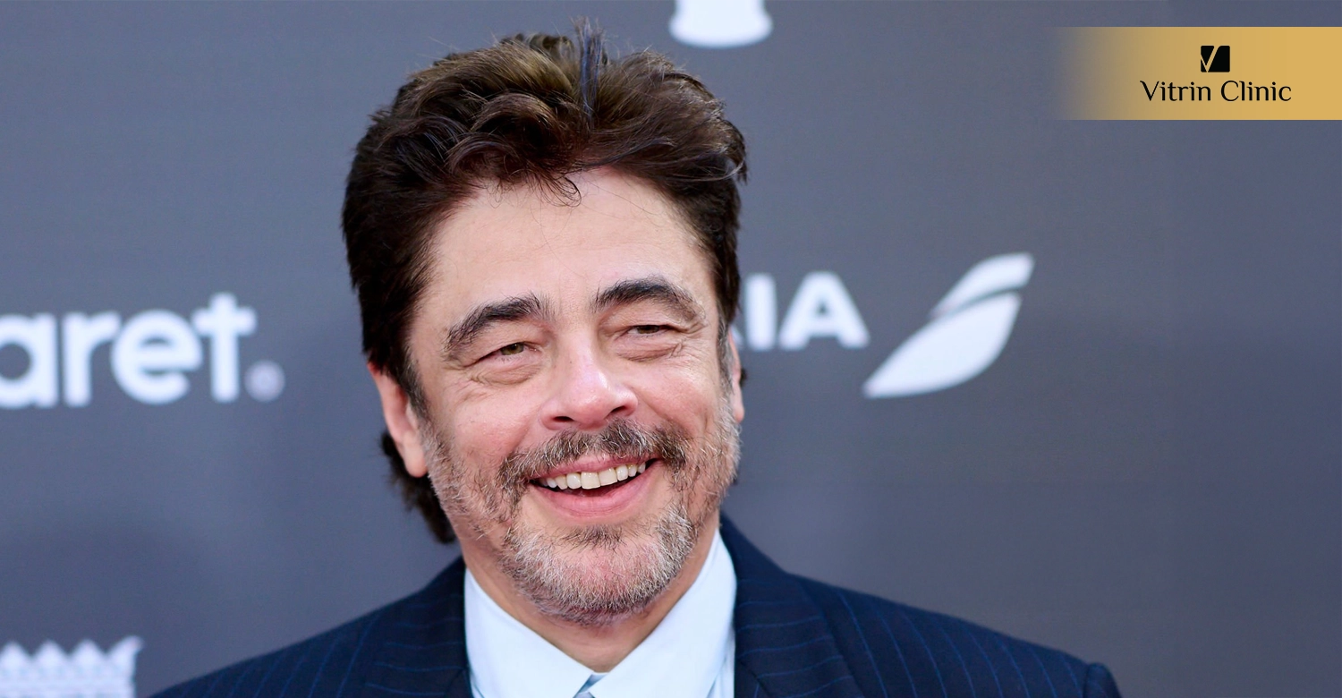 Signs of Professional Dental Work in Benicio del Toro smile 
