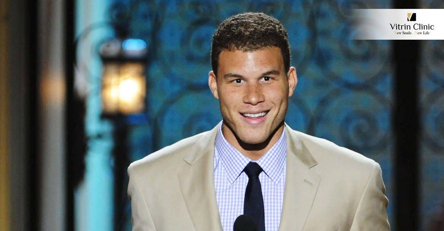 Blake Griffin Teeth