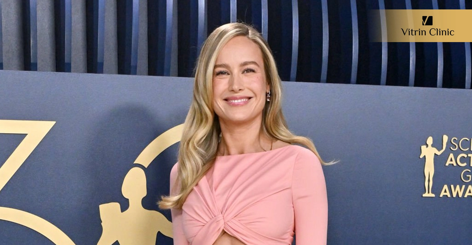 Brie Larson teeth
