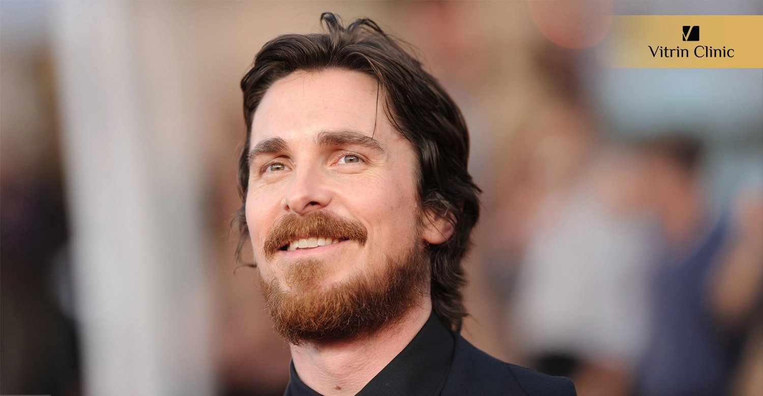 Christian Bale Teeth Whitening