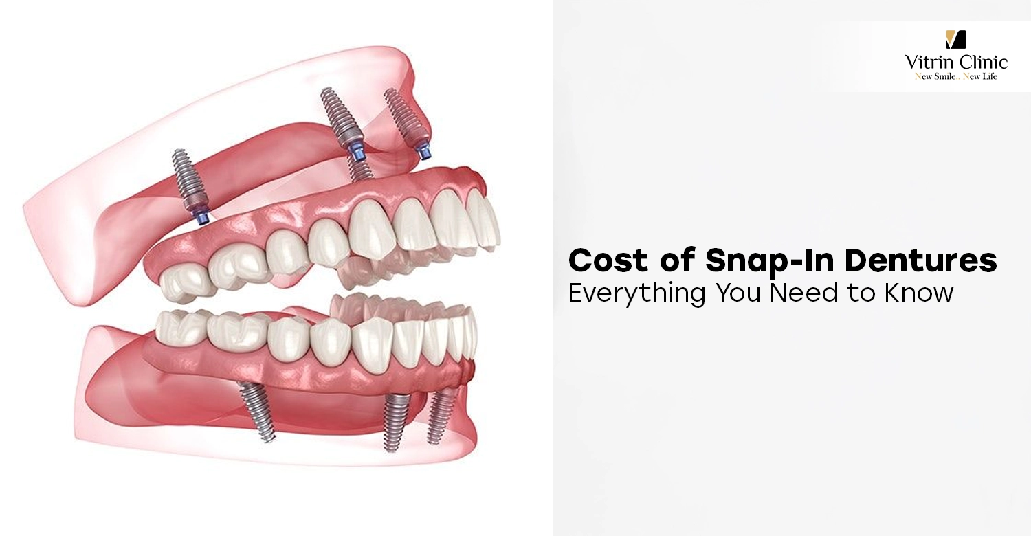 How Much Do Snap-In Dentures Cost