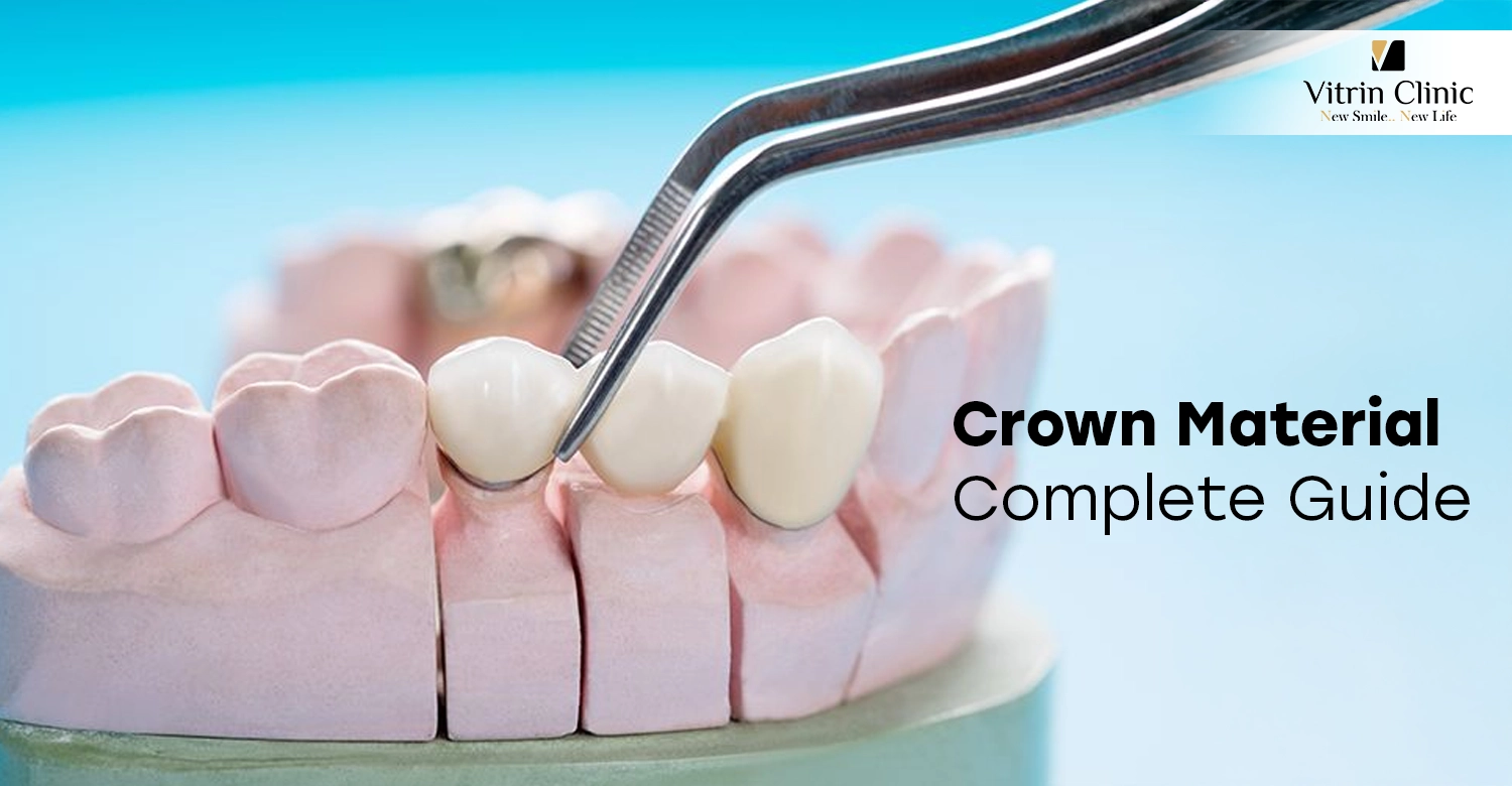 Crown Material