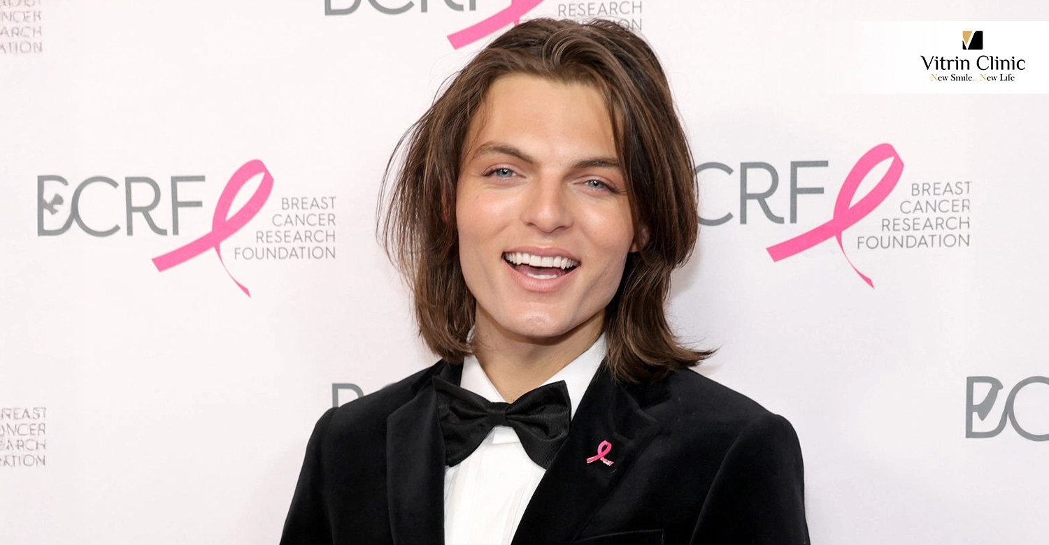 Damian Hurley Teeth