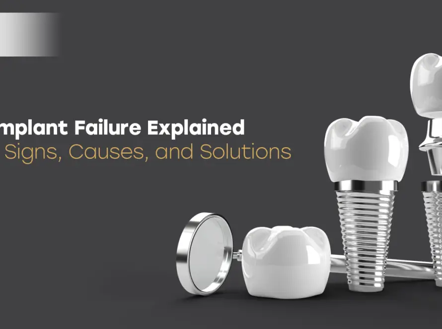 Dental Implant Failure