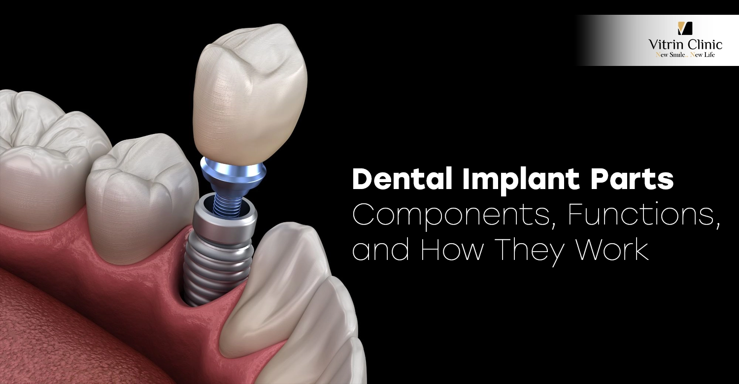 Dental implant parts