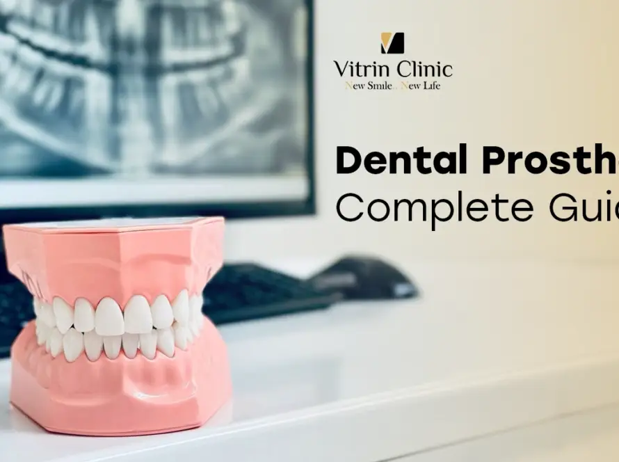Dental Prosthetics