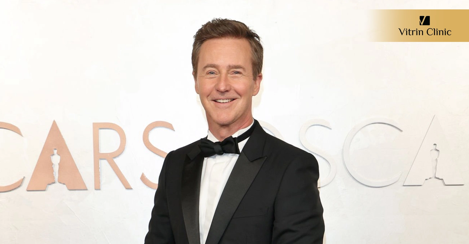 Dental Procedures to Recreate an Edward Norton–Inspired Smile