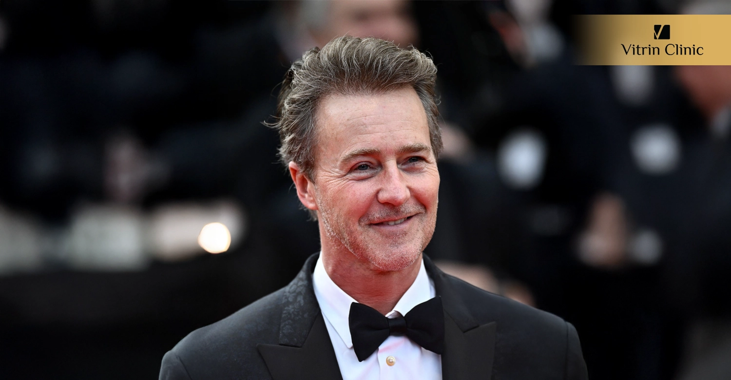 Edward Norton Teeth