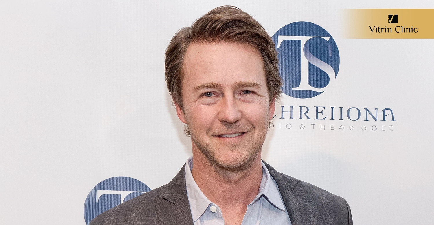 Did Edward Norton Get Veneers or Cosmetic Dental Work?