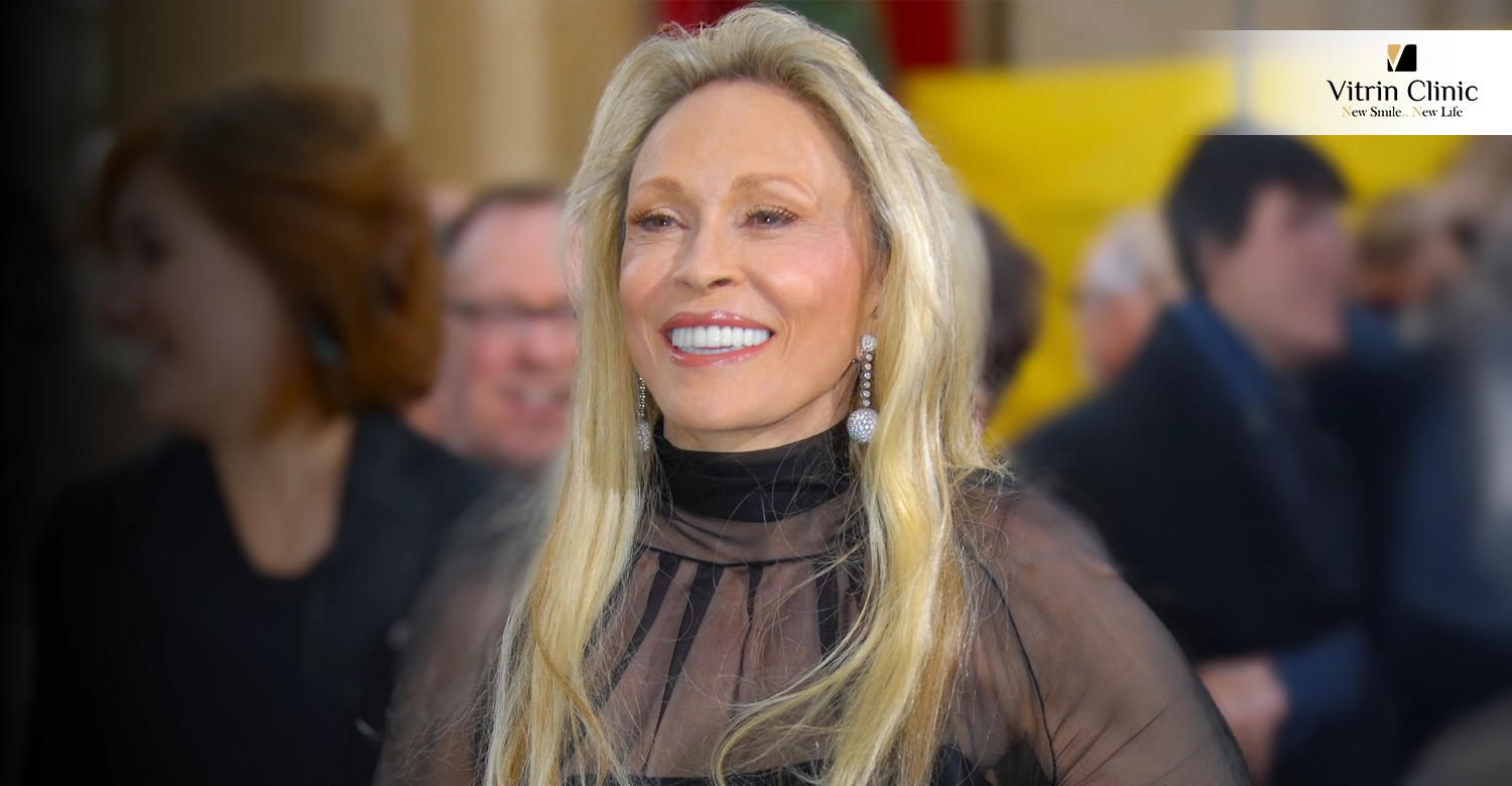 Faye Dunaway teeth