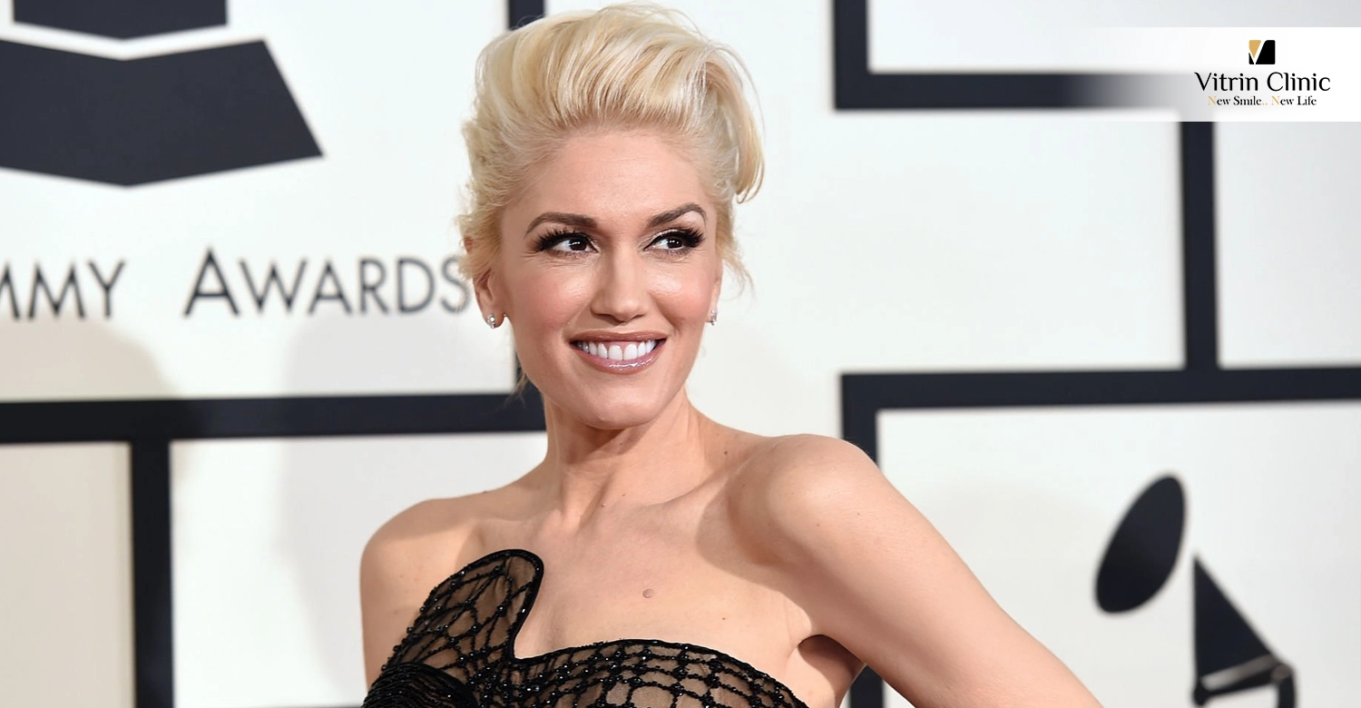 Gwen Stefani Teeth